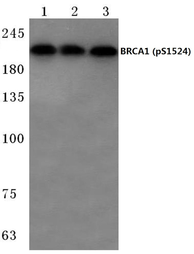 Phospho-BRCA1 (Ser1524) Antibody in Western Blot (WB)