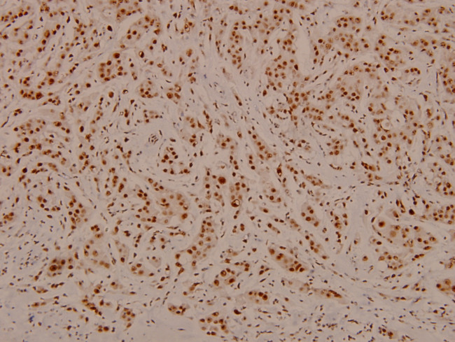 Phospho-C/EBP beta (Thr188, Thr235) Antibody in Immunohistochemistry (Paraffin) (IHC (P))