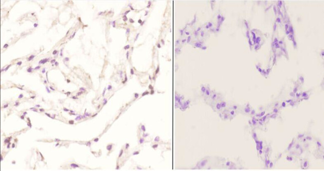 Phospho-c-Jun (Tyr170) Antibody in Immunohistochemistry (Paraffin) (IHC (P))