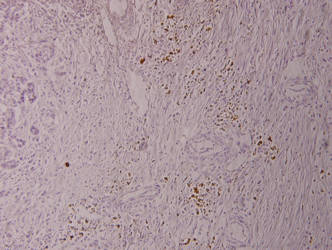 Phospho-ELK1 (Ser389) Antibody in Immunohistochemistry (Paraffin) (IHC (P))