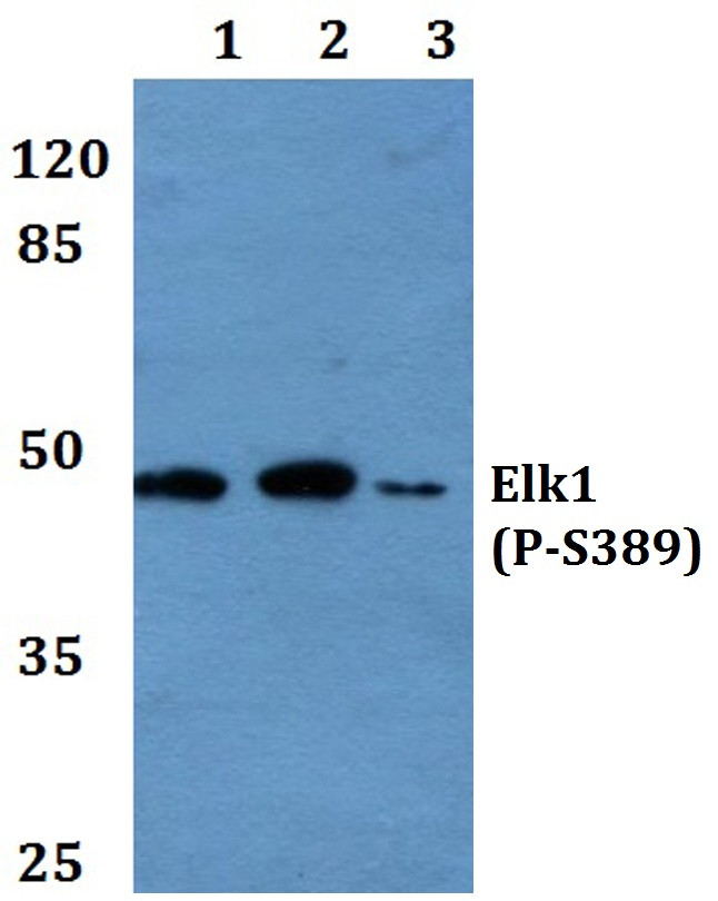 Phospho-ELK1 (Ser389) Antibody in Western Blot (WB)