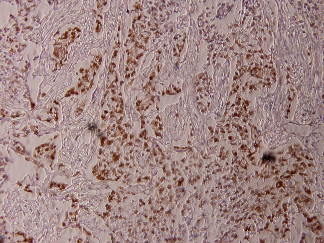 Phospho-ELK1 (Thr417) Antibody in Immunohistochemistry (Paraffin) (IHC (P))