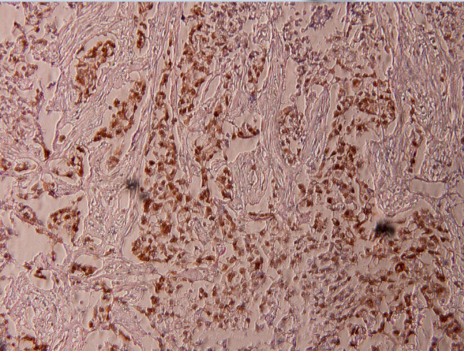 Phospho-ELK1 (Thr417) Antibody in Immunohistochemistry (Paraffin) (IHC (P))