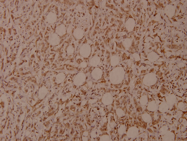 Phospho-Filamin A (Ser2152) Antibody in Immunohistochemistry (Paraffin) (IHC (P))