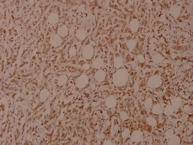 Phospho-Filamin A (Ser2152) Antibody in Immunohistochemistry (Paraffin) (IHC (P))