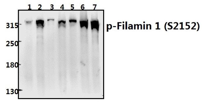 Phospho-Filamin A (Ser2152) Antibody in Western Blot (WB)