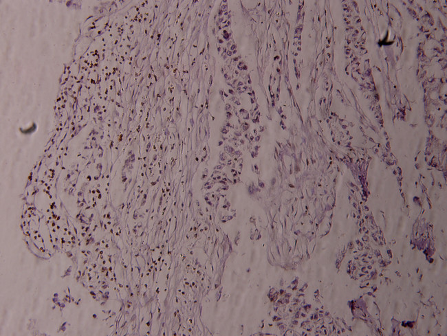 Phospho-Fyn (Tyr530) Antibody in Immunohistochemistry (Paraffin) (IHC (P))