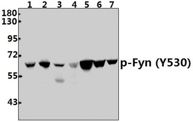 Phospho-Fyn (Tyr530) Antibody in Western Blot (WB)