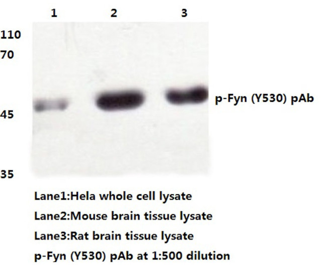 Phospho-Fyn (Tyr530) Antibody in Western Blot (WB)