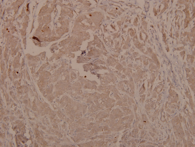 Phospho-GSK3 alpha/beta (Tyr279, Tyr216) Antibody in Immunohistochemistry (Paraffin) (IHC (P))