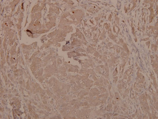 Phospho-GSK3 alpha/beta (Tyr279, Tyr216) Antibody in Immunohistochemistry (Paraffin) (IHC (P))