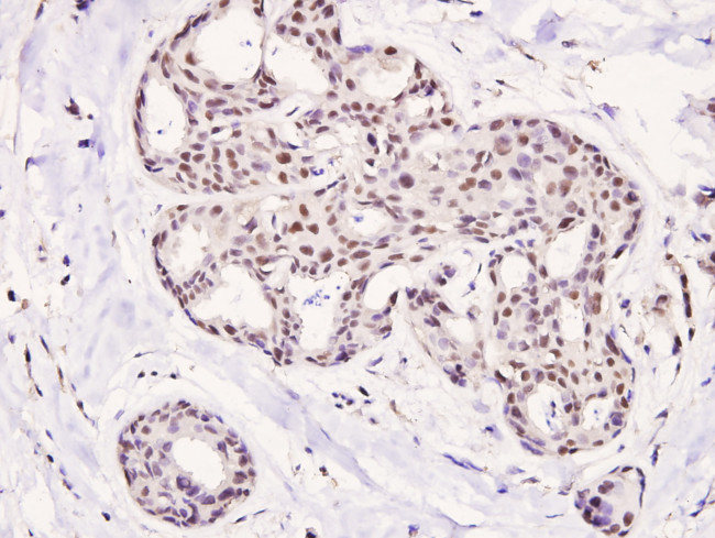 Phospho-HDAC5 (Ser498) Antibody in Immunohistochemistry (Paraffin) (IHC (P))