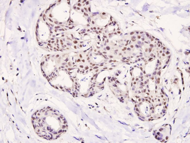 Phospho-HDAC5 (Ser498) Antibody in Immunohistochemistry (Paraffin) (IHC (P))