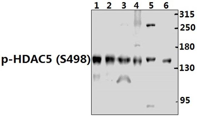 Phospho-HDAC5 (Ser498) Antibody in Western Blot (WB)