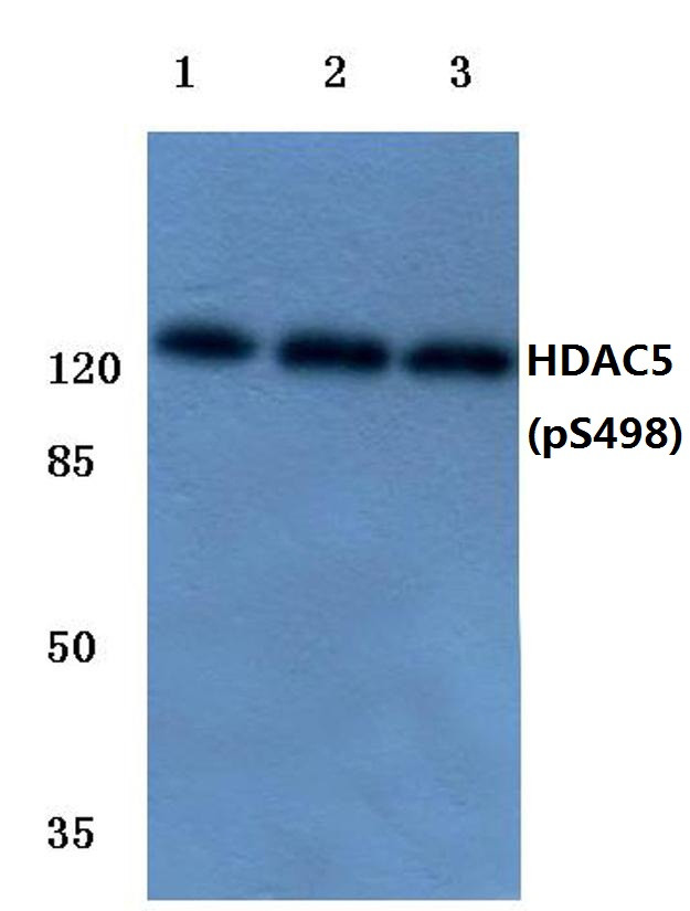 Phospho-HDAC5 (Ser498) Antibody in Western Blot (WB)