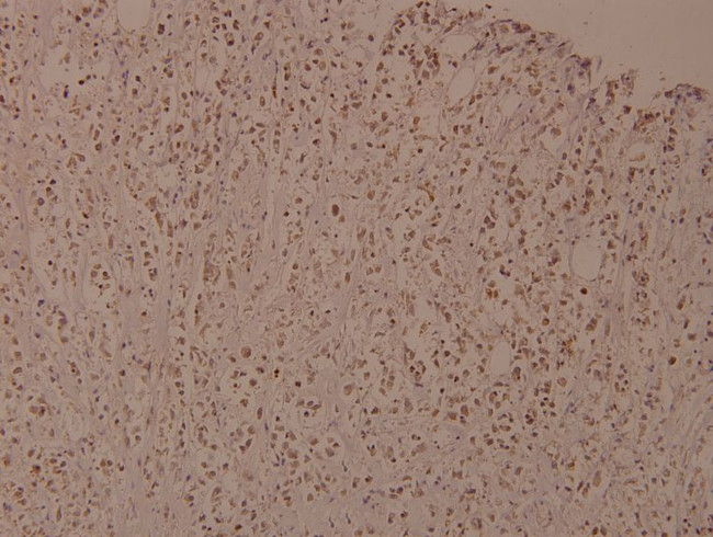 Phospho-IKK beta (Tyr188) Antibody in Immunohistochemistry (Paraffin) (IHC (P))