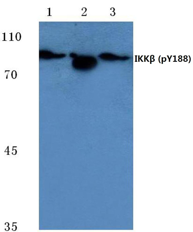 Phospho-IKK beta (Tyr188) Antibody in Western Blot (WB)