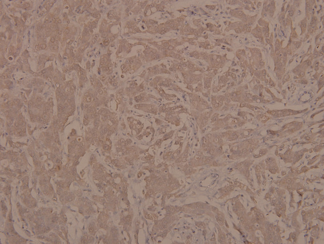 Phospho-JAK1 (Tyr1022) Antibody in Immunohistochemistry (Paraffin) (IHC (P))