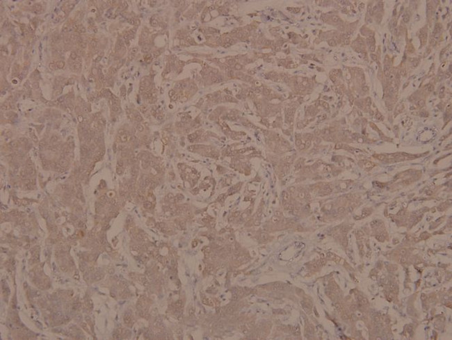 Phospho-JAK1 (Tyr1022) Antibody in Immunohistochemistry (Paraffin) (IHC (P))