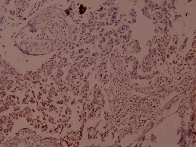 Phospho-JunD (Ser255) Antibody in Immunohistochemistry (Paraffin) (IHC (P))