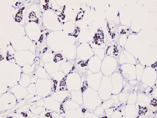 Phospho-LIMK2 (Thr505) Antibody in Immunohistochemistry (Paraffin) (IHC (P))