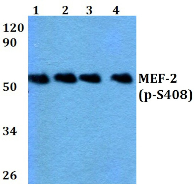 Phospho-MEF2A (Ser408) Antibody in Western Blot (WB)