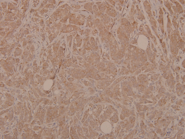 Phospho-MEK3 (Ser189) Antibody in Immunohistochemistry (Paraffin) (IHC (P))