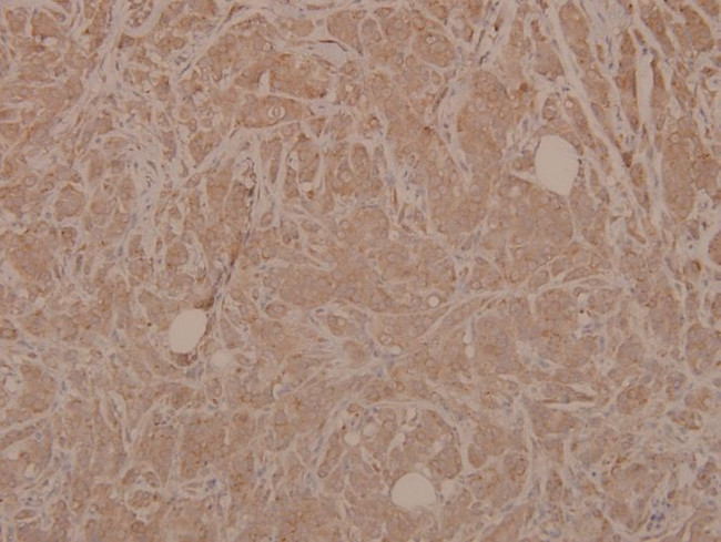 Phospho-MEK3 (Ser189) Antibody in Immunohistochemistry (Paraffin) (IHC (P))