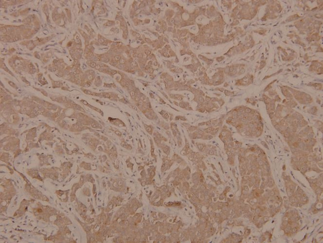 Phospho-MEK6 (Ser207) Antibody in Immunohistochemistry (Paraffin) (IHC (P))