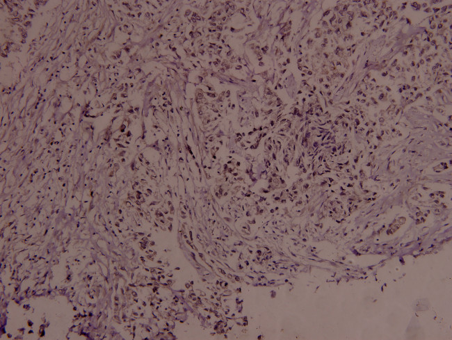 Phospho-c-Myc (Ser373) Antibody in Immunohistochemistry (Paraffin) (IHC (P))