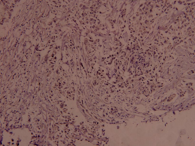 Phospho-c-Myc (Ser373) Antibody in Immunohistochemistry (Paraffin) (IHC (P))