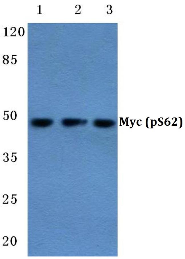 Phospho-c-Myc (Ser62) Antibody in Western Blot (WB)