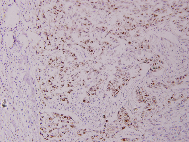 Phospho-c-Myc (Thr358) Antibody in Immunohistochemistry (Paraffin) (IHC (P))