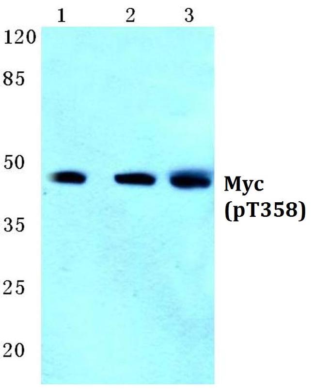 Phospho-c-Myc (Thr358) Antibody in Western Blot (WB)