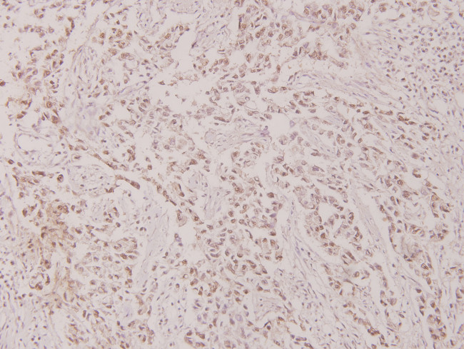 Phospho-c-Myc (Thr58) Antibody in Immunohistochemistry (Paraffin) (IHC (P))