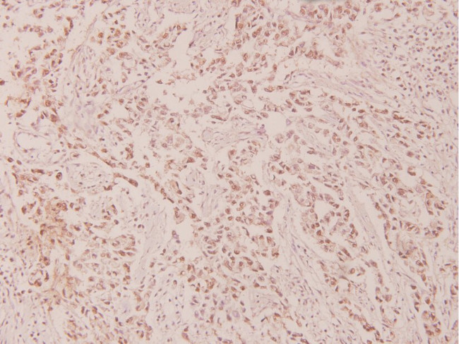 Phospho-c-Myc (Thr58) Antibody in Immunohistochemistry (Paraffin) (IHC (P))