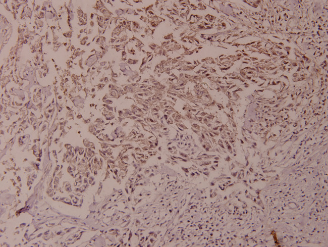 Phospho-NFkB p100 (Ser866) Antibody in Immunohistochemistry (Paraffin) (IHC (P))