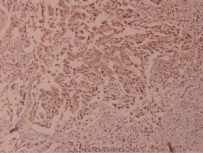 Phospho-NFkB p100 (Ser866) Antibody in Immunohistochemistry (Paraffin) (IHC (P))