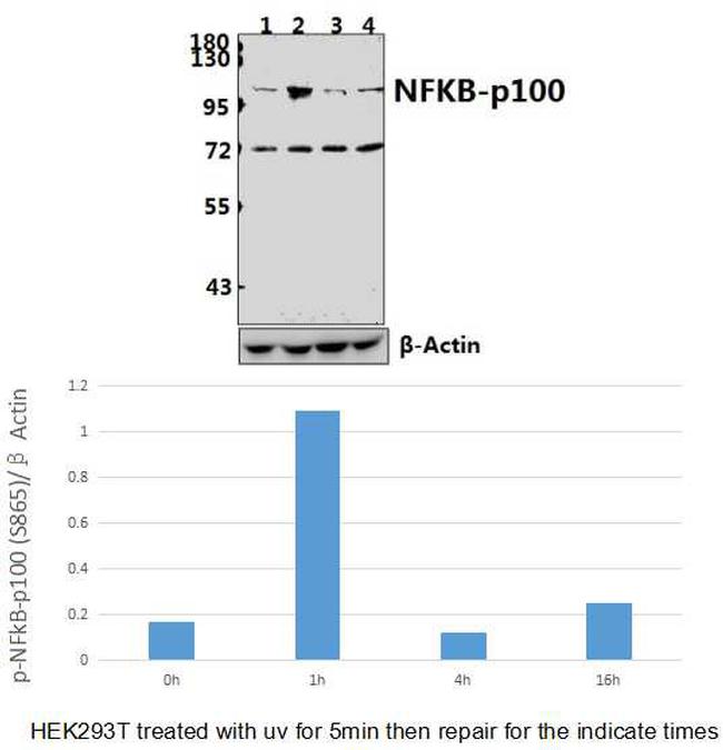 Phospho-NFkB p100 (Ser866) Antibody in Western Blot (WB)