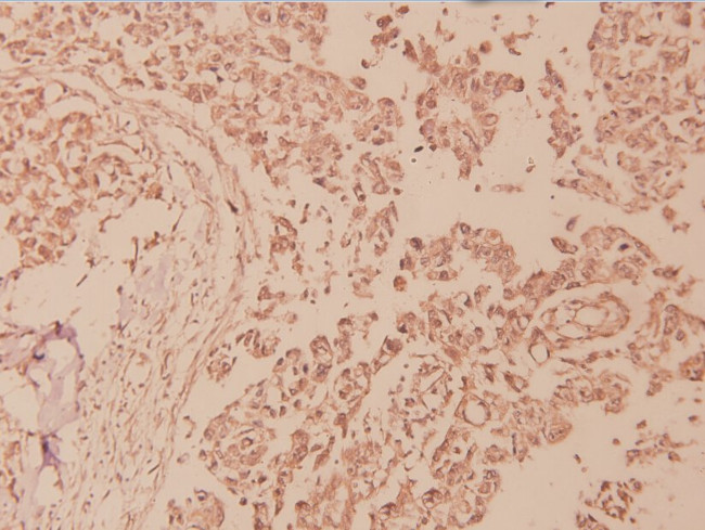 Phospho-NFkB p100 (Ser870) Antibody in Immunohistochemistry (Paraffin) (IHC (P))