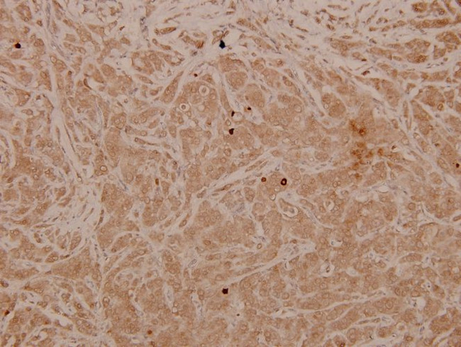 Phospho-MAP2K4 (Thr261) Antibody in Immunohistochemistry (Paraffin) (IHC (P))