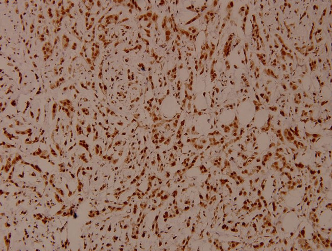 Phospho-SHP-1 (Tyr536) Antibody in Immunohistochemistry (Paraffin) (IHC (P))