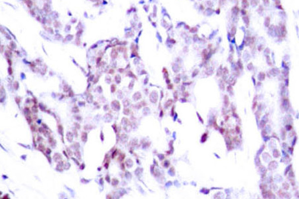 Phospho-STAT6 (Thr645) Antibody in Immunohistochemistry (Paraffin) (IHC (P))