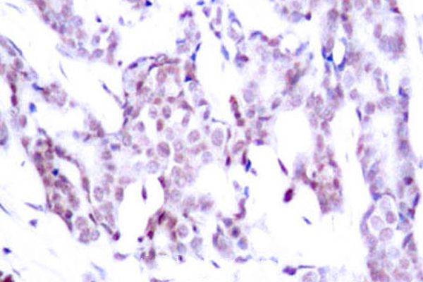 Phospho-STAT6 (Thr645) Antibody in Immunohistochemistry (Paraffin) (IHC (P))