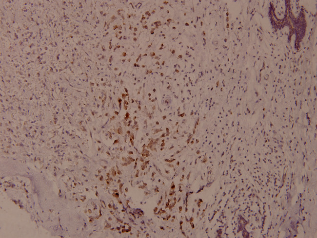 Phospho-Syk (Tyr525) Antibody in Immunohistochemistry (Paraffin) (IHC (P))