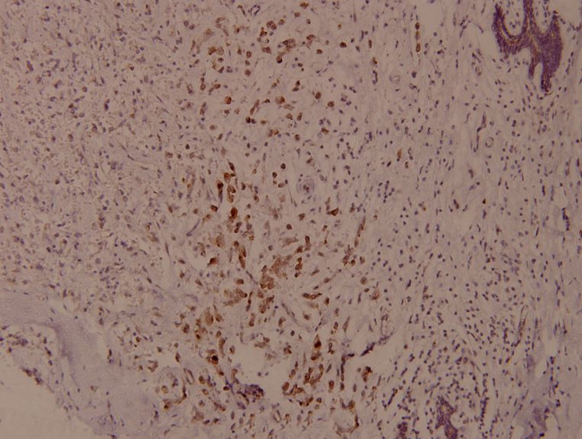 Phospho-Syk (Tyr525) Antibody in Immunohistochemistry (Paraffin) (IHC (P))