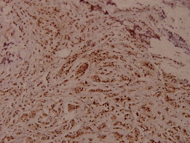 Phospho-WNK1 (Thr60) Antibody in Immunohistochemistry (Paraffin) (IHC (P))