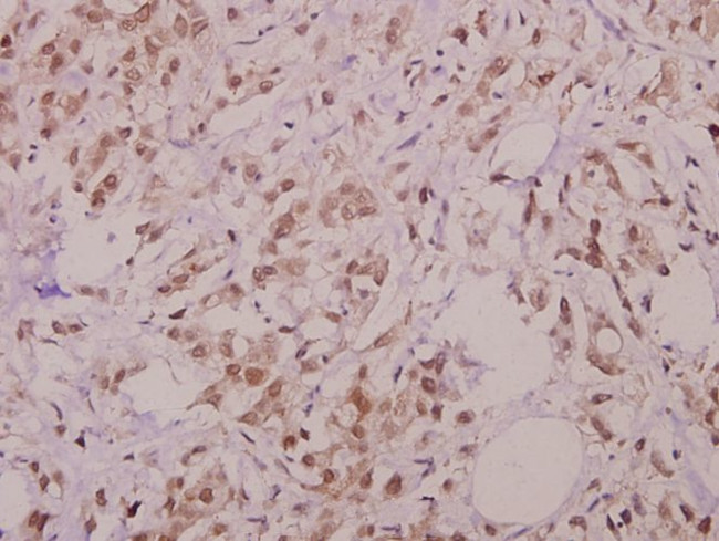 Phospho-BIK (Thr33) Antibody in Immunohistochemistry (Paraffin) (IHC (P))