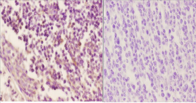 Phospho-Cyclin B1 (Ser126) Antibody in Immunohistochemistry (Paraffin) (IHC (P))