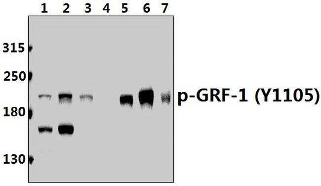 Phospho-GRF-1 (Tyr1105) Antibody in Western Blot (WB)